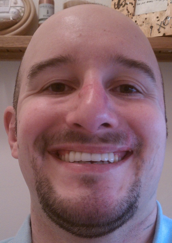 Teeth finally complete a 1 1/2 yrs. later!